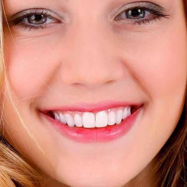 Pasa Dental tedavi sonrası hasta gülüşü - Beyaz ve düzgün dişler